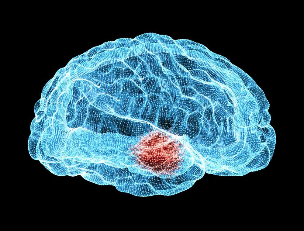 Adjunctive Opicapone for Parkinson Disease 